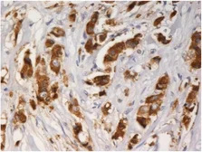 Anti-AGR3 antibody [AGR3.1] used in IHC (Paraffin sections) (IHC-P). GTX80241