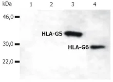 Anti-HLA-G antibody [5A6G7] used in Western Blot (WB). GTX80260
