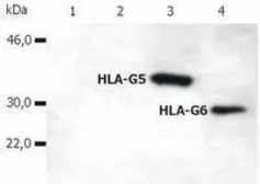 Anti-HLA-G antibody [5A6G7] (PE) used in Western Blot (WB). GTX80262