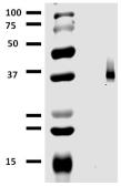 Anti-EpCAM antibody [323/A3] used in Western Blot (WB). GTX80286