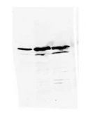 Anti-hnRNP K antibody [3C2] used in Western Blot (WB). GTX80387