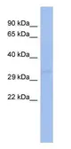 Anti-hCG beta antibody [WM16/71] used in Western Blot (WB). GTX80394