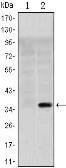 Anti-SLC22A1 antibody [2C5] used in Western Blot (WB). GTX80400