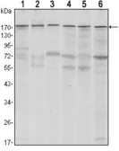 Anti-SETDB1 antibody [5H6D4] used in Western Blot (WB). GTX80409