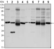 Anti-FOXD3 antibody [5G9] used in Western Blot (WB). GTX80414