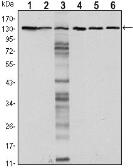 Anti-E-Cadherin antibody [7A2] used in Western Blot (WB). GTX80415