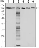 Anti-E-Cadherin antibody [7A2] used in Western Blot (WB). GTX80415