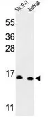 Anti-SNRPD3 antibody, C-term used in Western Blot (WB). GTX80441