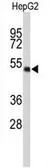Anti-WDR37 antibody, C-term used in Western Blot (WB). GTX80465