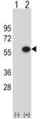 Anti-ERGIC3 antibody, N-term used in Western Blot (WB). GTX80486