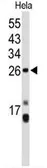 Anti-CENPH antibody, Internal used in Western Blot (WB). GTX80491