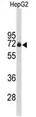 Anti-FBXO3 antibody, C-term used in Western Blot (WB). GTX80503