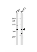 Anti-DHRS3 antibody, Internal used in Western Blot (WB). GTX80507
