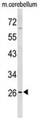 Anti-PXMP4 antibody, Internal used in Western Blot (WB). GTX80511