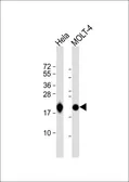 Anti-RPL18A antibody, C-term used in Western Blot (WB). GTX80536
