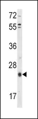 Anti-TIMP3 antibody, Internal used in Western Blot (WB). GTX80547