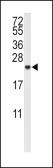 Anti-IL10 antibody, Internal used in Western Blot (WB). GTX80555