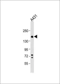 Anti-Integrin alpha 2 antibody, C-term used in Western Blot (WB). GTX80593