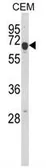 Anti-EDIL3 antibody, Internal used in Western Blot (WB). GTX80621