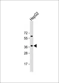 Anti-E2F5 antibody, N-term used in Western Blot (WB). GTX80623