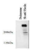 Anti-AKAP12 antibody used in Western Blot (WB). GTX80649