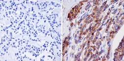 Anti-NMDAR2B antibody [NR2B] used in IHC (Paraffin sections) (IHC-P). GTX80691