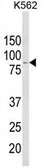 Anti-ALDH18A1 antibody, Internal used in Western Blot (WB). GTX80929