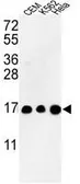 Anti-Histone H3 antibody, N-term used in Western Blot (WB). GTX80943