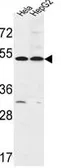 Anti-FERMT1 antibody, Internal used in Western Blot (WB). GTX80946