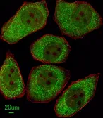 Anti-ALOX12 antibody, C-term used in Immunocytochemistry/ Immunofluorescence (ICC/IF). GTX80966