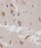 Anti-Glutaminase antibody, C-term used in IHC (Paraffin sections) (IHC-P). GTX81012