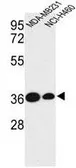 Anti-Tafazzin / TAZ antibody, N-term used in Western Blot (WB). GTX81015