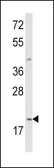 Anti-IL12A / IL12 p35 antibody, C-term used in Western Blot (WB). GTX81020