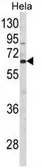 Anti-CTPS2 antibody, N-term used in Western Blot (WB). GTX81032