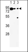Anti-TRP2 antibody, N-term used in Western Blot (WB). GTX81039