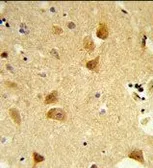 Anti-Derlin 1 antibody, C-term used in IHC (Paraffin sections) (IHC-P). GTX81054