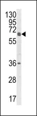 Anti-CYP2C18 antibody, C-term used in Western Blot (WB). GTX81067