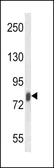 Anti-Lactoferrin antibody used in Western Blot (WB). GTX81085