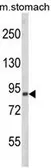 Anti-PARD3 antibody, C-term used in Western Blot (WB). GTX81098