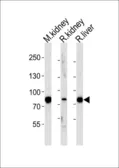 Anti-EHHADH antibody, C-term used in Western Blot (WB). GTX81126