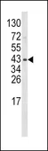 Anti-Wnt5b antibody, Internal used in Western Blot (WB). GTX81146