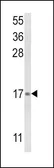 Anti-LTC4S antibody, N-term used in Western Blot (WB). GTX81159
