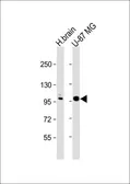 Anti-ANO5 antibody, C-term used in Western Blot (WB). GTX81161