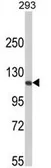 Anti-Rb antibody, C-term used in Western Blot (WB). GTX81164