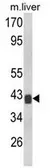 Anti-TOB1 antibody, N-term used in Western Blot (WB). GTX81167
