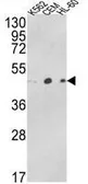 Anti-ACTR3B antibody, C-term used in Western Blot (WB). GTX81186