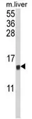 Anti-MIP1 alpha antibody, C-term used in Western Blot (WB). GTX81195