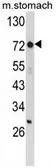 Anti-ZFP36 antibody, Internal used in Western Blot (WB). GTX81199