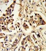 Anti-ARHGAP18 antibody, Internal used in IHC (Paraffin sections) (IHC-P). GTX81203