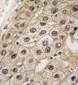 Anti-PERK antibody, N-term used in IHC (Paraffin sections) (IHC-P). GTX81222